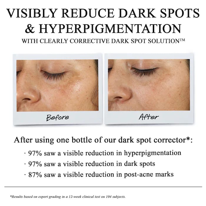 Kiehl's Clearly Corrective Dark Spot Solution