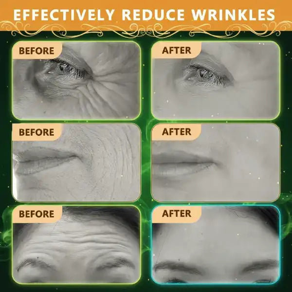 Botox BeeVenom Anti Wrinkle Cream ( Buy 1 Get 1 Free )