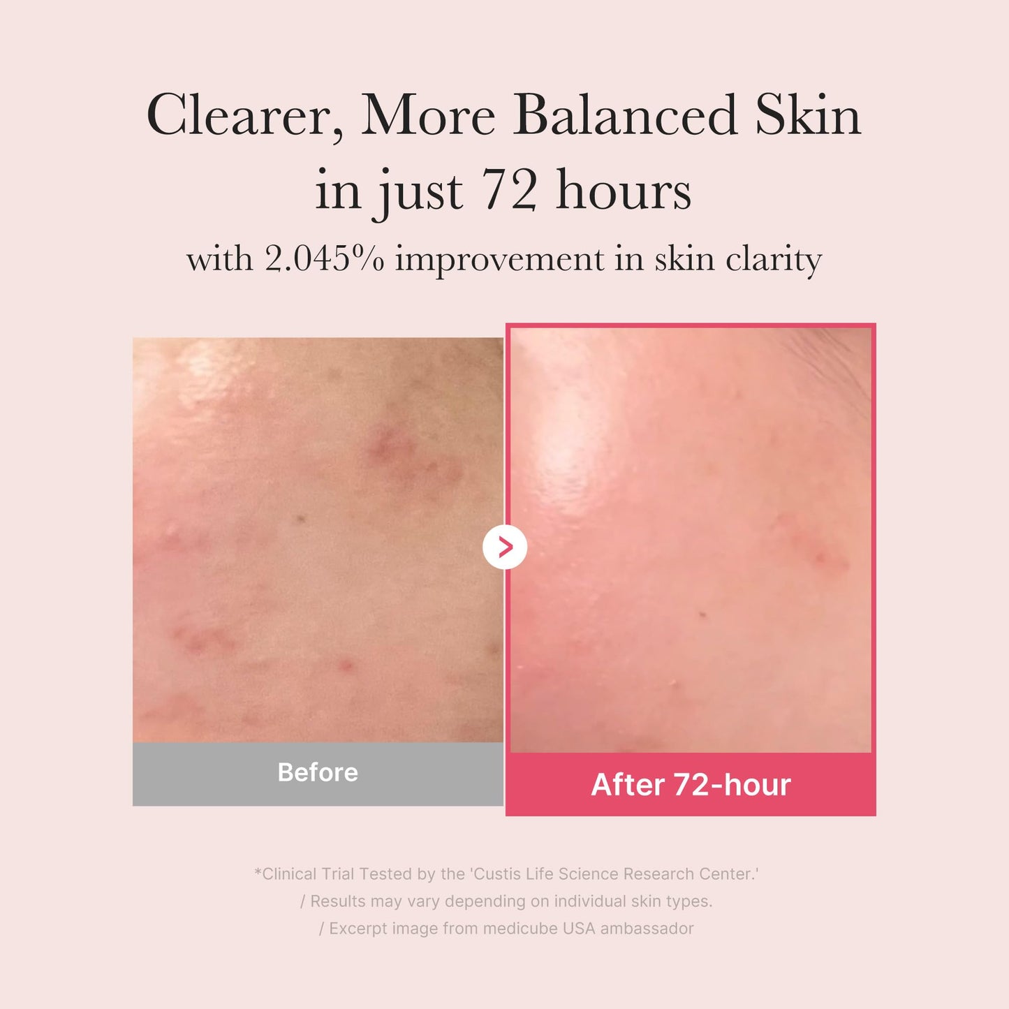 Medicube TXA Niacinamide 15 Serum