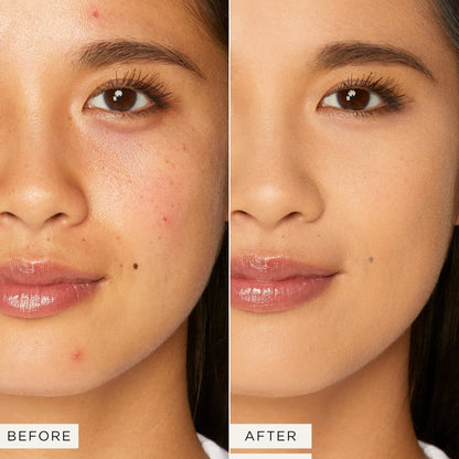 Tarte Shape Tape Contour Concealer